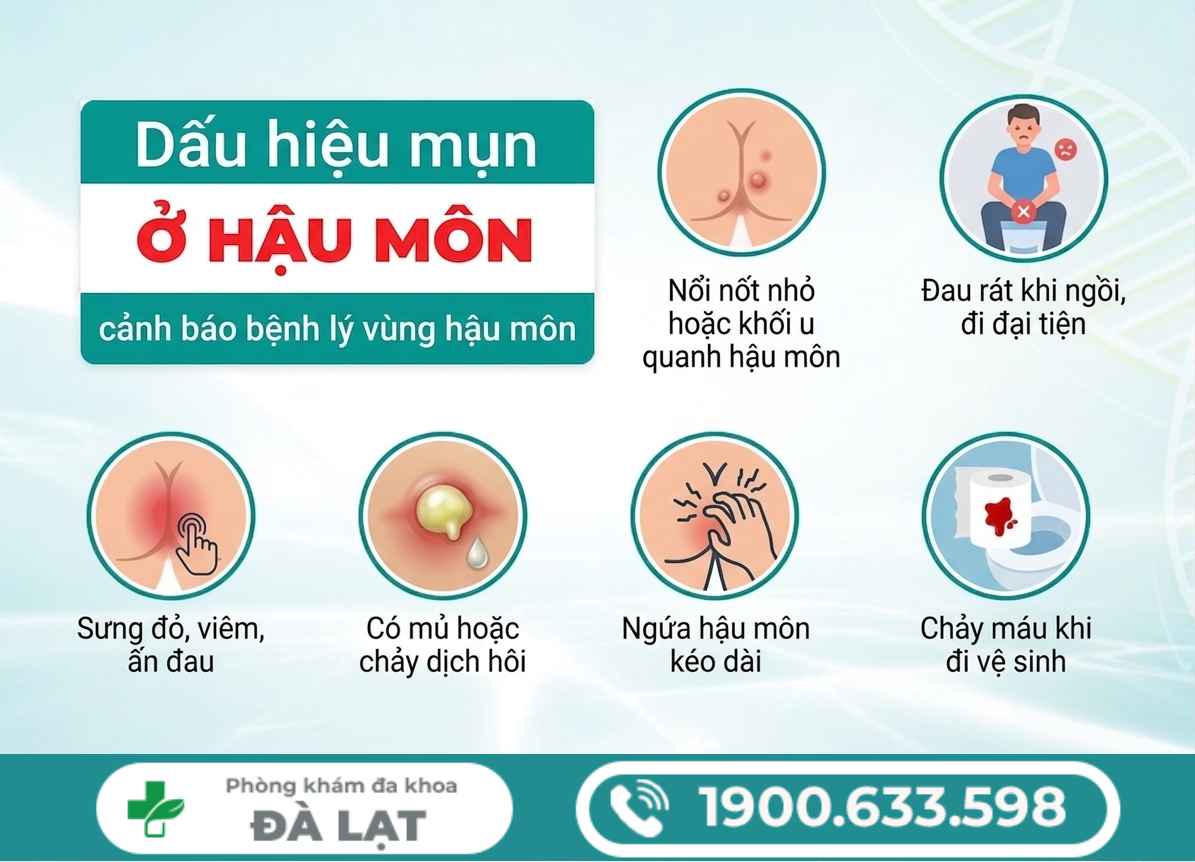 Hình ảnh minh họa